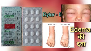 हाथ  पैर में सूजन Edema की दवा  Dytor 5 tablet uses in hindi  Torsemide tablet uses in hindi [upl. by Marigolde]