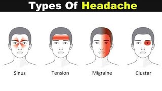 Causes of Headache 😔 in Urdu with full details [upl. by Yttam]