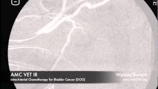 Interventional Radiology IntraArterial Chemotherapy for Bladder Cancer [upl. by Bonacci331]