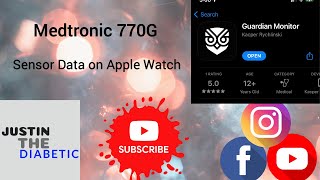 Guardian Monitor App Medtronic Data on Apple Watch [upl. by Krm]