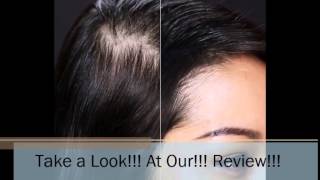 Toppik Hair Building Fibers Reviews [upl. by Sophronia]