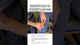 Snuff Box Tenderness  Scaphoid Fracture Diagnosis  Sensitivity and Specificity [upl. by Selig208]