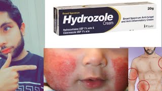 Hydrozole cream usehydrozole cream full reviewrashes on baby hipsskin infection treatment [upl. by Enitsirhc]