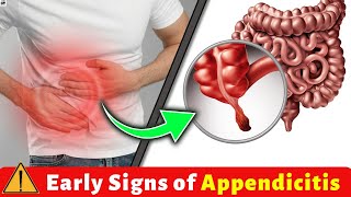 Early Warning Signs amp Symptoms of Appendicitis [upl. by Ahsaenat]