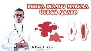 MAXAA KU GARAN KARTAA DHIIGA IMAADO MARKAA UURKA QAADO Drfaris [upl. by Draneb]