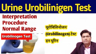 Urine Urobilinogen Test in Hindi   Ehrlichs aldehyde test [upl. by Ennazor836]