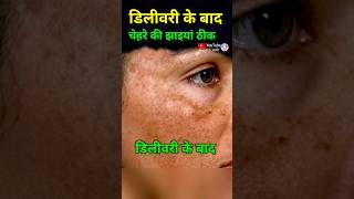 डिलीवरी के बाद चेहरे की झाइयां ठीक करने का उपाय melasma chloasma skincare [upl. by Sioled]