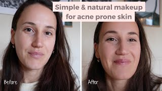 Simple amp Natural Makeup For AcneProne Skin [upl. by Schell632]