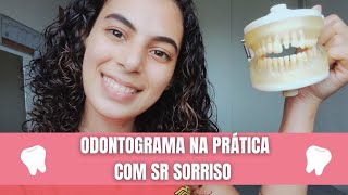 ODONTOGRAMA NA PRÁTICA  COMO FAZER ANALISE DOS DENTES NO ODONTOGRAMA  DR SORRISO [upl. by Caroline]