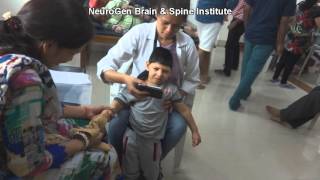 Treatment for Spastic Quadriplegia Cerebral Palsy [upl. by Elohcim]