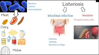 listeriosis  Symptoms and treatment Listeria monocytogenes [upl. by Mallina]