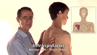 quotRhomboid Painquot How To Fix Shoulder Blade Pain Quickly [upl. by Anrat550]