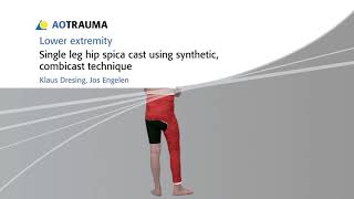 Aotrauma Single leg hip spica [upl. by Currie]