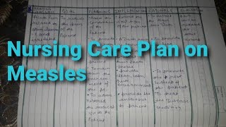 Measles nursing care plan 4 daignosis nursingcriteria nursingcareplan [upl. by Gualtiero]