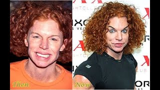 Carrot Top Before and After Photos  Carrot Top Before and After Steroids [upl. by Haleeuqa]