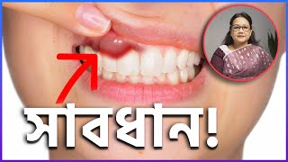 দাঁতের মাড়ি ফুলে গিয়েছে Gingivitis and its Solution [upl. by Ephrayim]