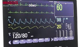 How to connect a Patient monitor to Central Monitoring System [upl. by Llesram998]