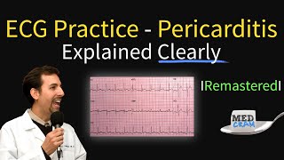 ECG Interpretation Practice  Pericarditis on EKG Explained [upl. by Denie]