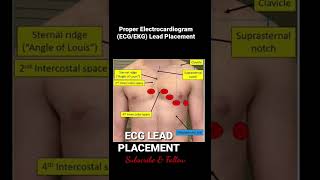 Proper Electrocardiogram ECGEKG Lead Placement [upl. by Ayk314]