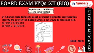 A human male decides to adopt a surgical method for contraception Identify the point in the diag [upl. by Semadar981]