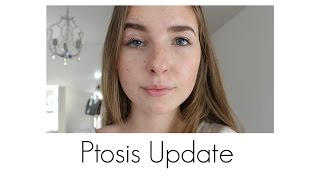 Update und Vorgeschichte zu meinem AugeLid  Ptosis X [upl. by Inoy434]