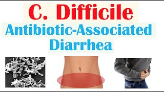 Clostridium Difficile AntibioticAssociated Diarrhea Risk Factors Symptoms Diagnosis Treatment [upl. by Ybbob]