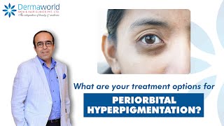 Periorbital Hyperpigmentation how to treat and how to cure  Dr Rohit Batra explains [upl. by Forrer593]