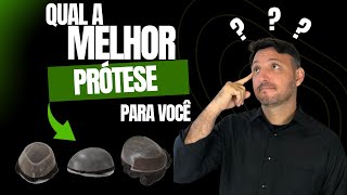 QUAL É MELHOR PRÓTESE CAPILAR [upl. by Samanthia]