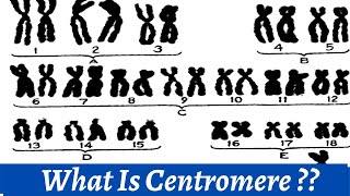 Centromere And Kinetochore  How we use centromere to classify chromosomes   Histology [upl. by Brita]