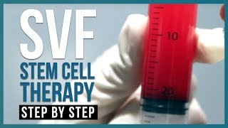 Stromal Vascular Fraction Stem Cell Therapy SVF Therapy  StepbyStep [upl. by Basia650]