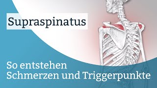 Supraspinatus Schmerzen Triggerpunkte und deren Aktivierung [upl. by Yonita]