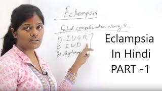 Definition of Eclampsia with type lecture in hindi Itiology  Sign amp symptom  stages of convulsion [upl. by Groscr]