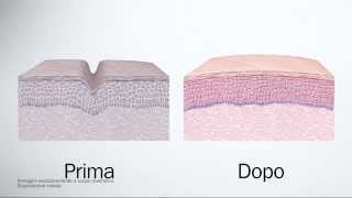 Fillerina Biorevitalizing  Trattamento effetto filler dermocosmetico ed effetto biorivitalizzante [upl. by Lecroy]