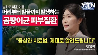 메디컬 인사이트 37회 피부과 전문의가 전하는 곰팡이균 피부질환의 증상과 치료법  YTN [upl. by Ahsaek699]