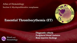 Essential Thrombocythemia ET [upl. by Neret]