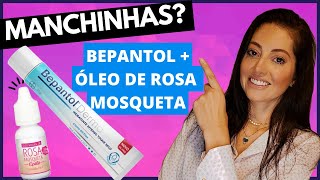 BEPANTOLÓLEO DE ROSA MOSQUETA CLAREIA MANCHAS MELASMAS A Verdade Sobre o óleo de Rosa Mosqueta [upl. by Yecal]