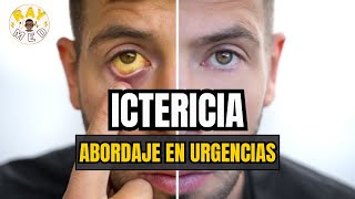 ICTERICIA  ABORDAJE CLÍNICO DE URGENCIAS🚨 [upl. by Lanie570]