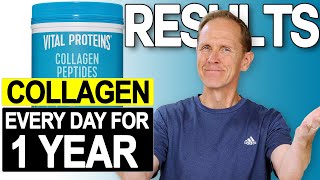 Vital Proteins Collagen Peptides  Results After One Year [upl. by Bensen]