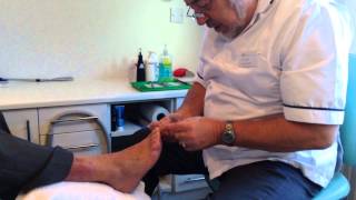 Ian Fowler Chiropodist at The Therapy Company demonstrates his work [upl. by Aileen]