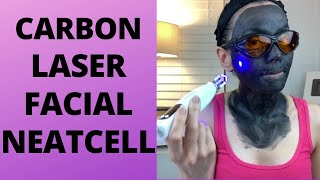 Carbon Laser Facial using Neatcell Picosecond Pen  At Home Carbon Facial  At Home Picosend Laser [upl. by Soracco7]