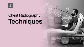 Chest Radiography Techniques [upl. by Adnav]