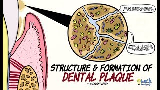 Dental Plaque Structure and Formation [upl. by Ahsekin]