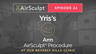 AirSculpt TV Episode 22 Yris Palmers Arm AirSculpt Treatment [upl. by Einaffyt]