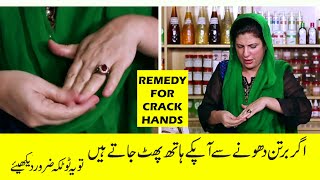 Crack hands and feet home Treatment by Dr Bilquis Shaikh  Phatay hathon ka ilaaj [upl. by Lexie]