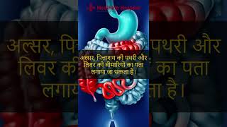 पेट का अल्ट्रासाउंड क्यों आवश्यक है  Abdominal Ultrasound  Best Gastro Hospital in Kanpur [upl. by Naihr518]