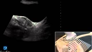 3D Cómo hacer Examen ecográfico de la Pelvis en Mujer  Ultrasonido SonoSite [upl. by Irrehs]