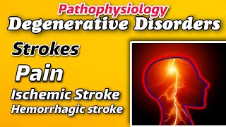 Pathophysiology of DEGENERATIVE DISORDERS  Strokes amp its types  Pain  Expalined by Tutor [upl. by Fineberg]