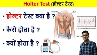 Holter Test in Hindi  Holter test for heart  holter test kya hota hai  holter test kaise hota hai [upl. by Ahsitniuq]