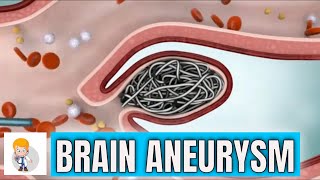 Brain cerebral Aneurysm Types symptoms and surgical repair [upl. by Karwan]