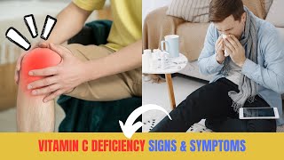 6 Signs And Symptoms Of Vitamin C Deficiency You Should Never Ignore [upl. by Rolyab]